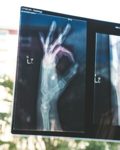 Performance Lab D3 + K2 can help bone health